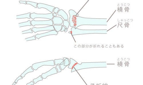 醋鳖甲与炙鳖甲的区别-【醋鳖甲与炙鳖甲功效一样吗】炙鳖甲和醋鳖甲有什么区别 - 炙鳖甲与醋鳖甲有什么区别网